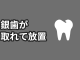 銀歯が取れて5年放置